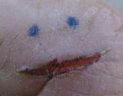 SASROD